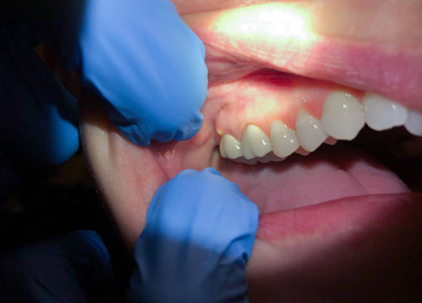 Best Emergency Treatment for Jaw Pain or Injury in Belpre, OH